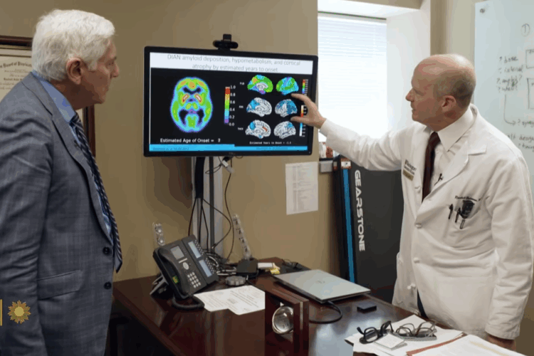 Promising clinical trials in Alzheimer's prevention